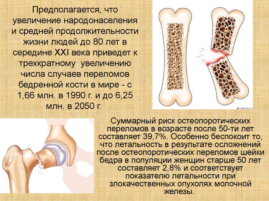 В химическом составе костей пожилого человека. Остеопороз переломы костей. Остеопороз презентация. Изменение костей с возрастом. Переломы при остеопорозе.