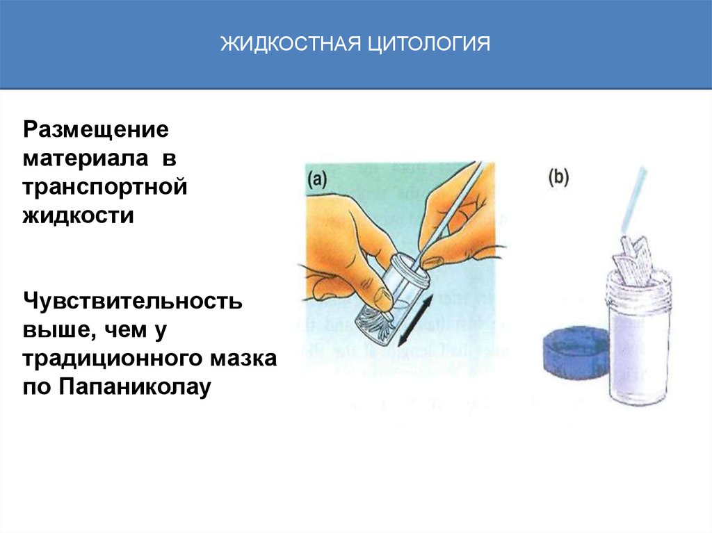 Соскоб папаниколау