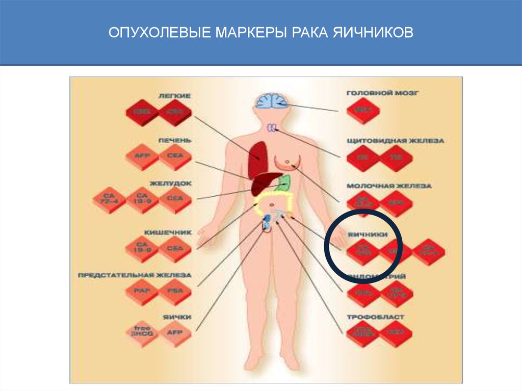 Опухолевый маркер не 4