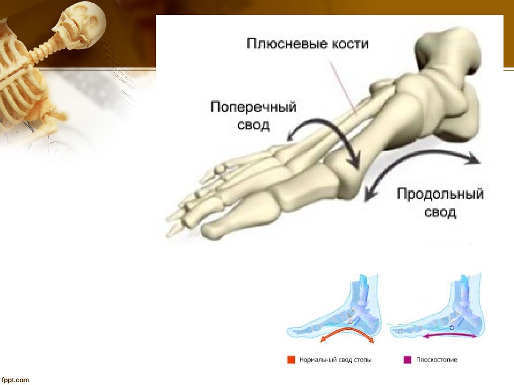 Сводчатая стопа. Продольный и поперечный свод стопы. Рессорный свод стопы кости. Сводчатая кость стопы это. Кости свода стопы анатомия.