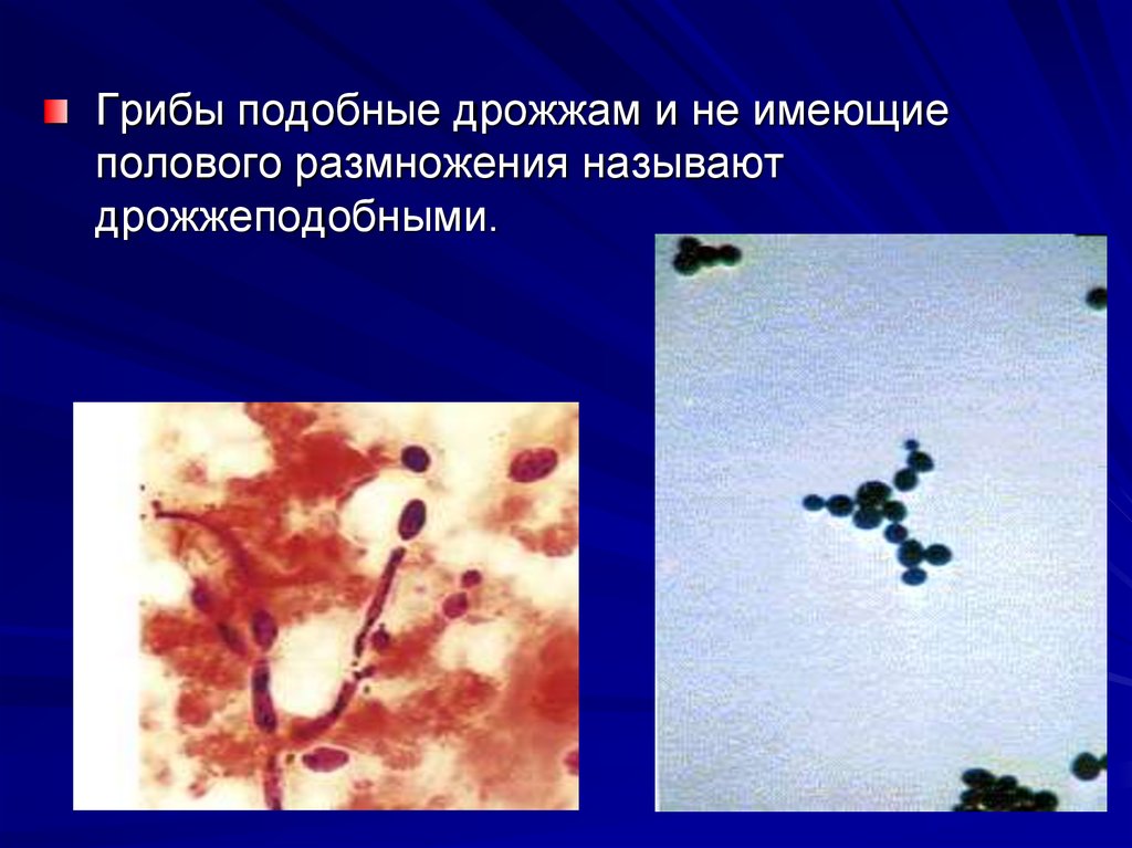 Микроскопические грибы презентация 3 класс