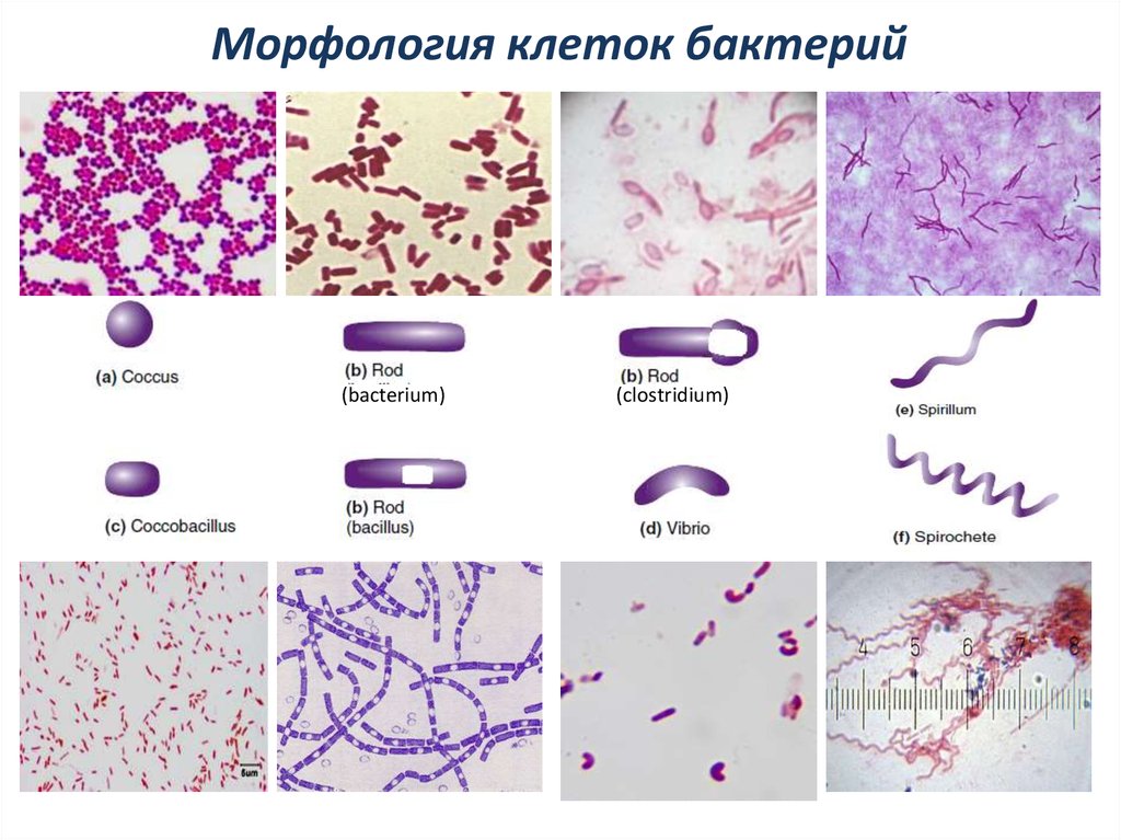 Форма и окраска. Морфология основных групп бактерий микробиология. Морфология бактерий кокки. Морфология микробов микробиология. Морфология микроорганизмов по форме.