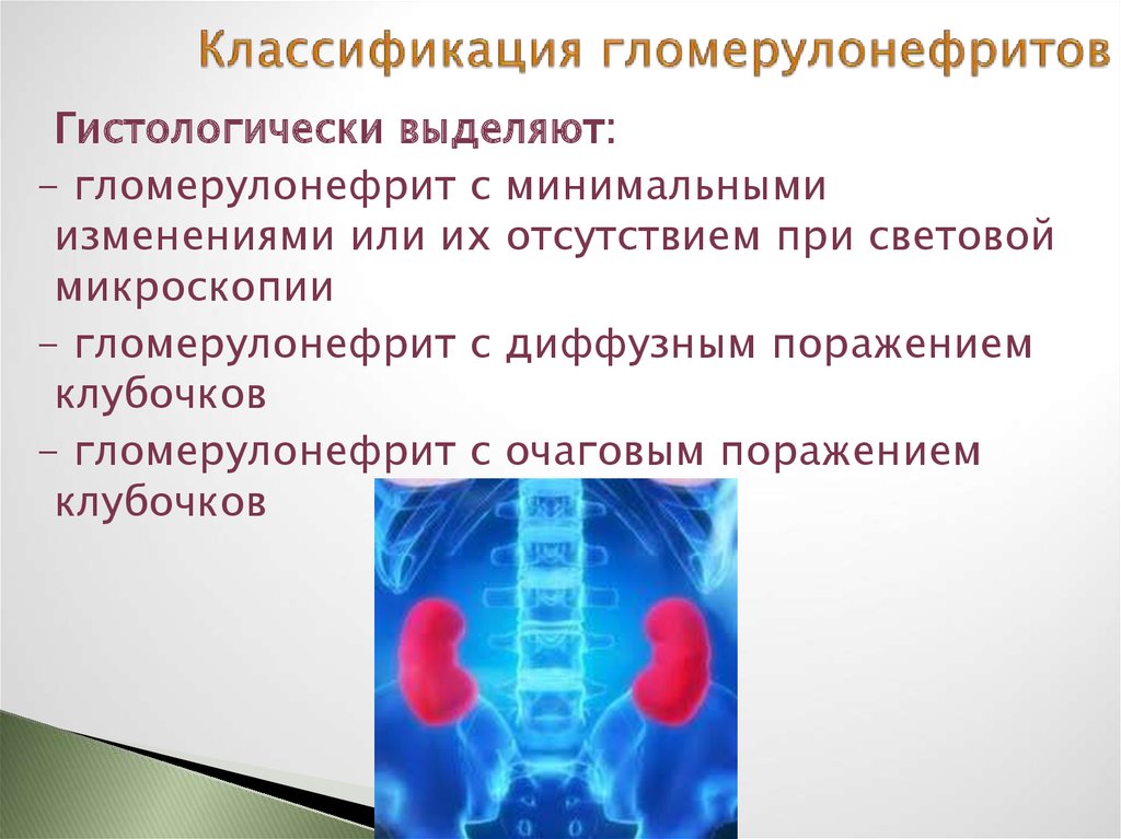 Острый гломерулонефрит триада. Гломерулонефрит классификация. Гломерулонефрит с минимальными изменениями. Быстропрогрессирующий гломерулонефрит этиология. Быстропрогрессирующий гломерулонефрит классификация.