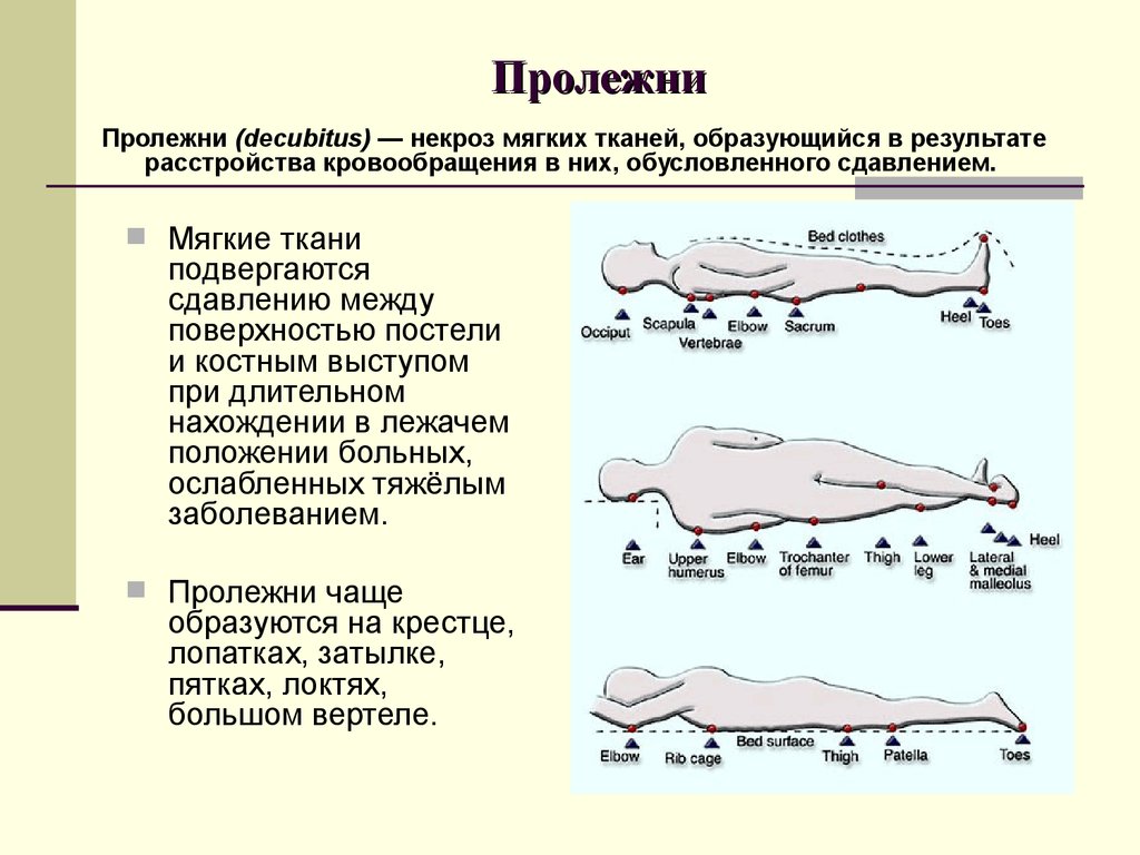 Пролежни на ягодицах фото лечение