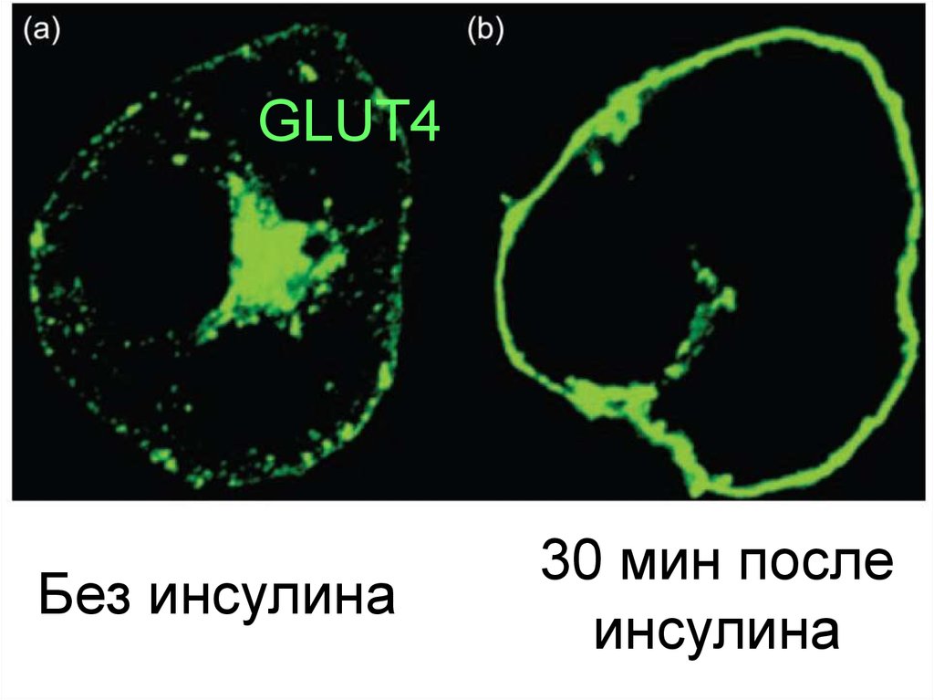 Без инсулина