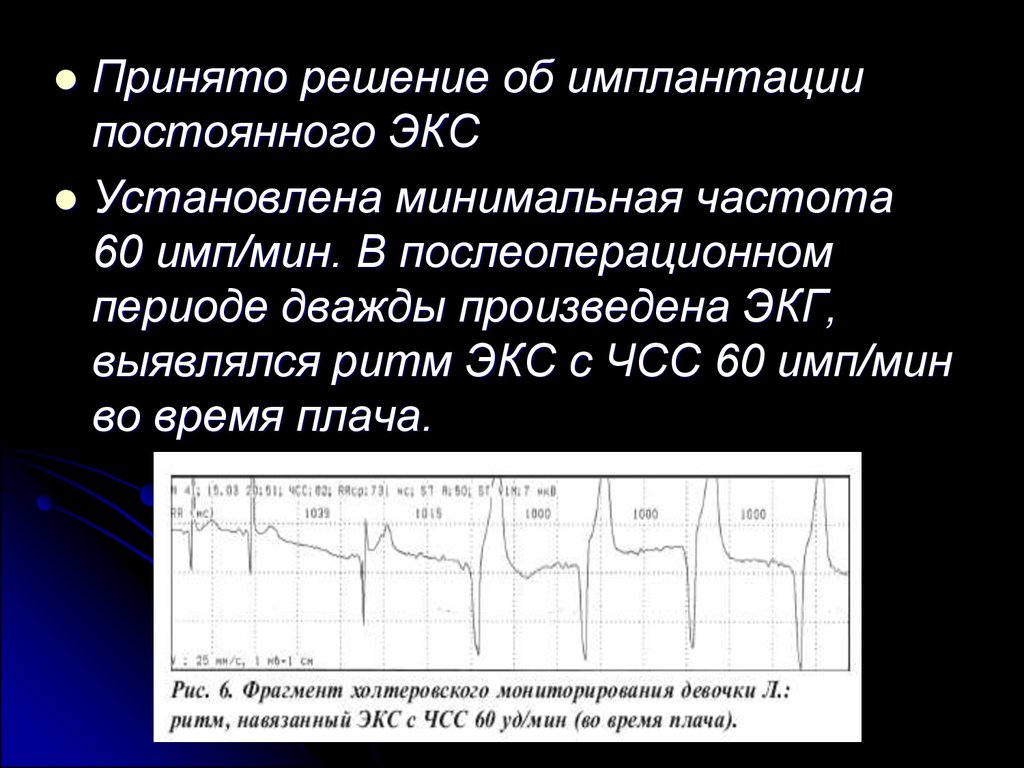 Минимальная частота