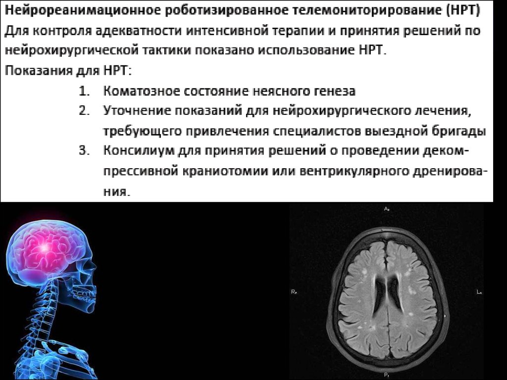 Церебральная недостаточность. Церебральный ангиоспазм. Головной мозга и церебральная недостаточность. Церебральный ангиоспазм когда проходит.