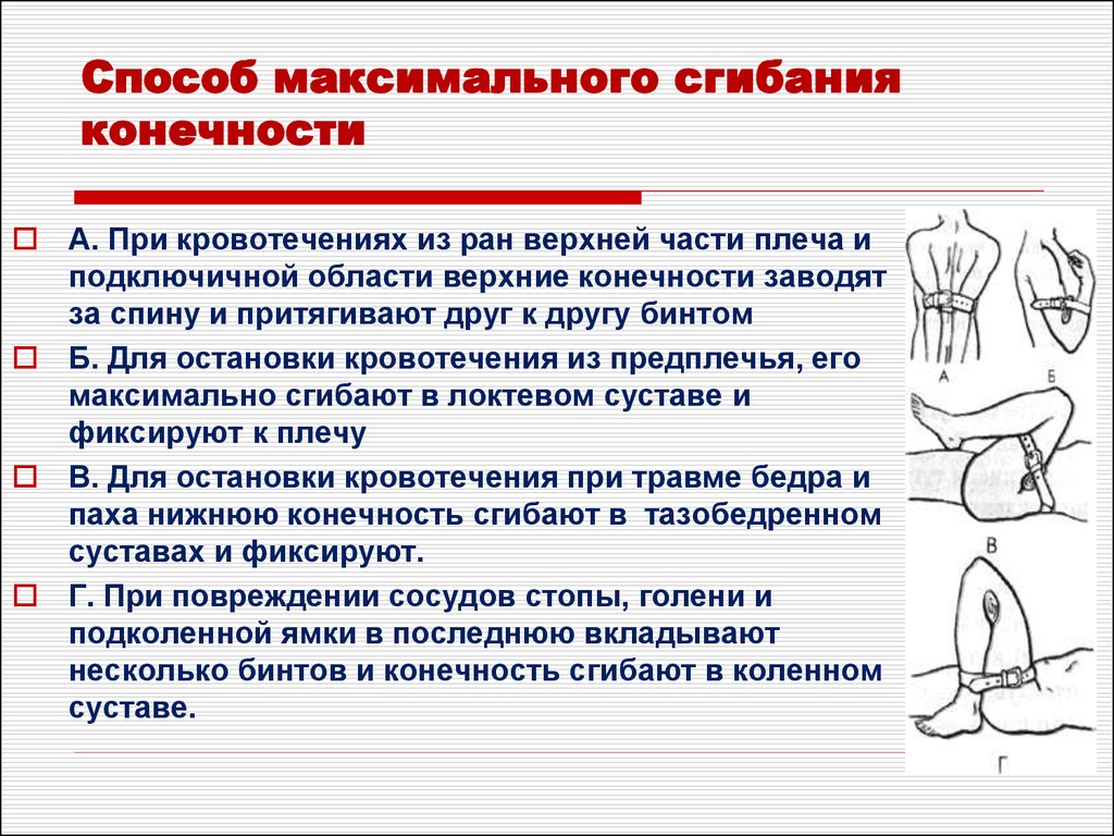 Временная остановка кровотечения алгоритм. Остановка кровотечения максимальным сгибанием конечности алгоритм. Остановка кровотечения методом максимального сгибания конечности. При кровотечениях из РАН верхней части плеча и подключичной области. Метод максимального сгибания конечности в суставе необходимо.