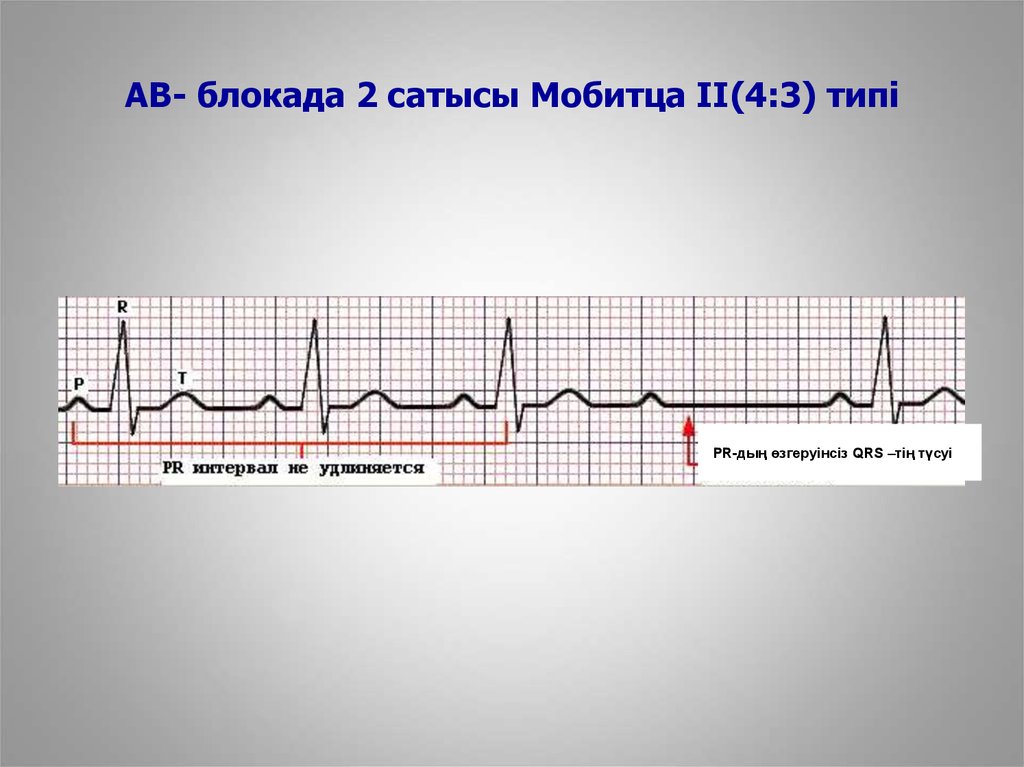 Ав блокада карта вызова