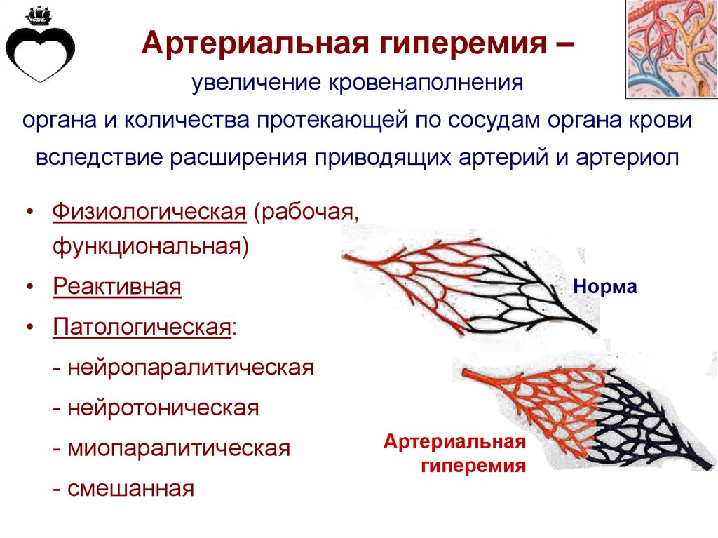 Артериальная гиперемия рисунок