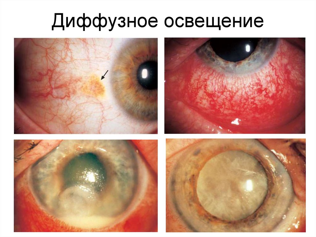 Диффузное освещение