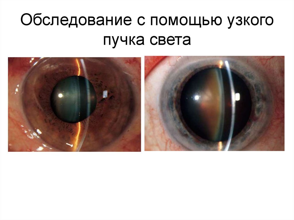 Обследование с помощью узкого пучка света