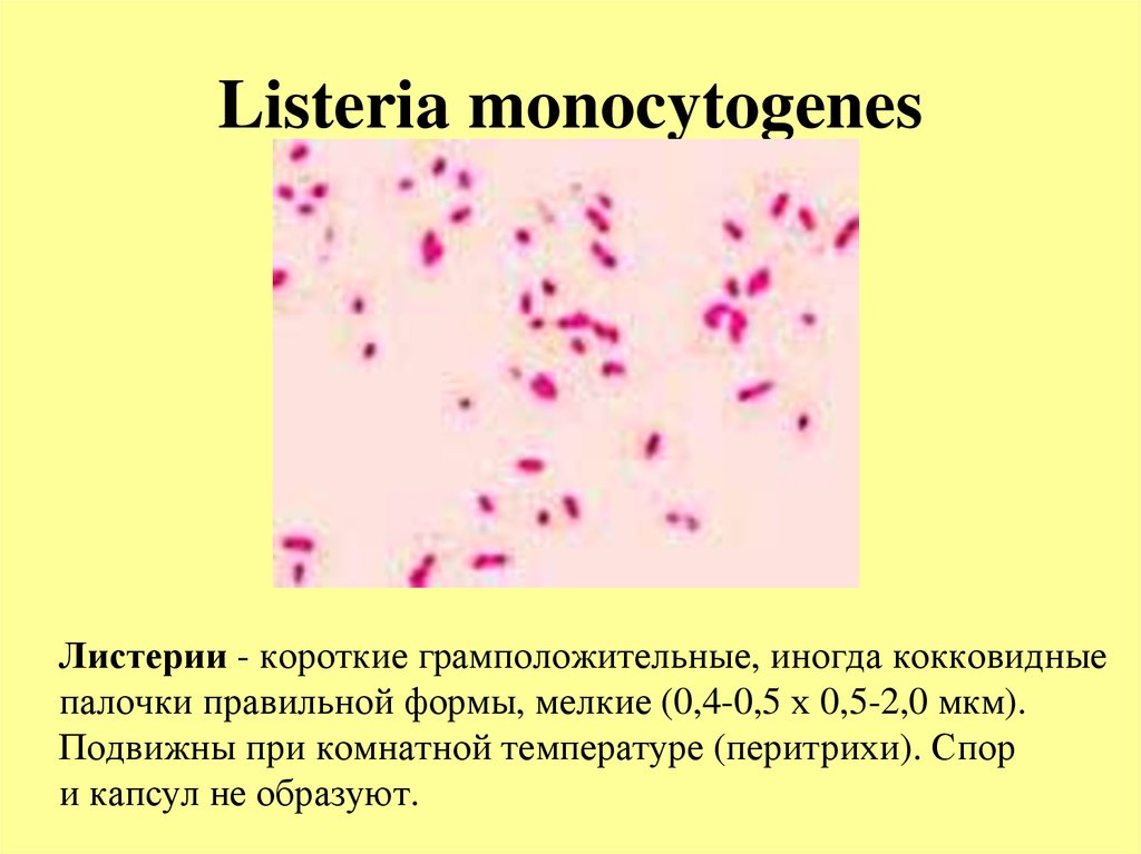 Listeria monocytogenes что это