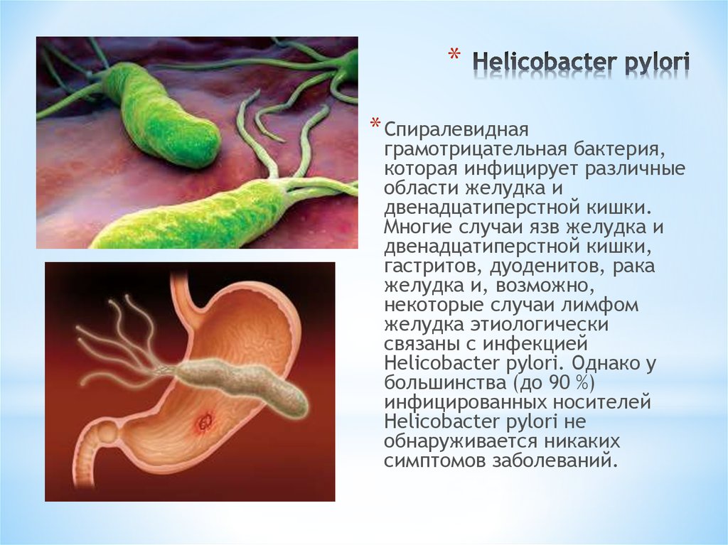 Бактерии хеликобактер причины. Хеликобактер пилори патогенные микроорганизмы. Пилорический хеликобактер. Язва желудка хеликобактер. Спиралевидная бактерия Helicobacter pylori.