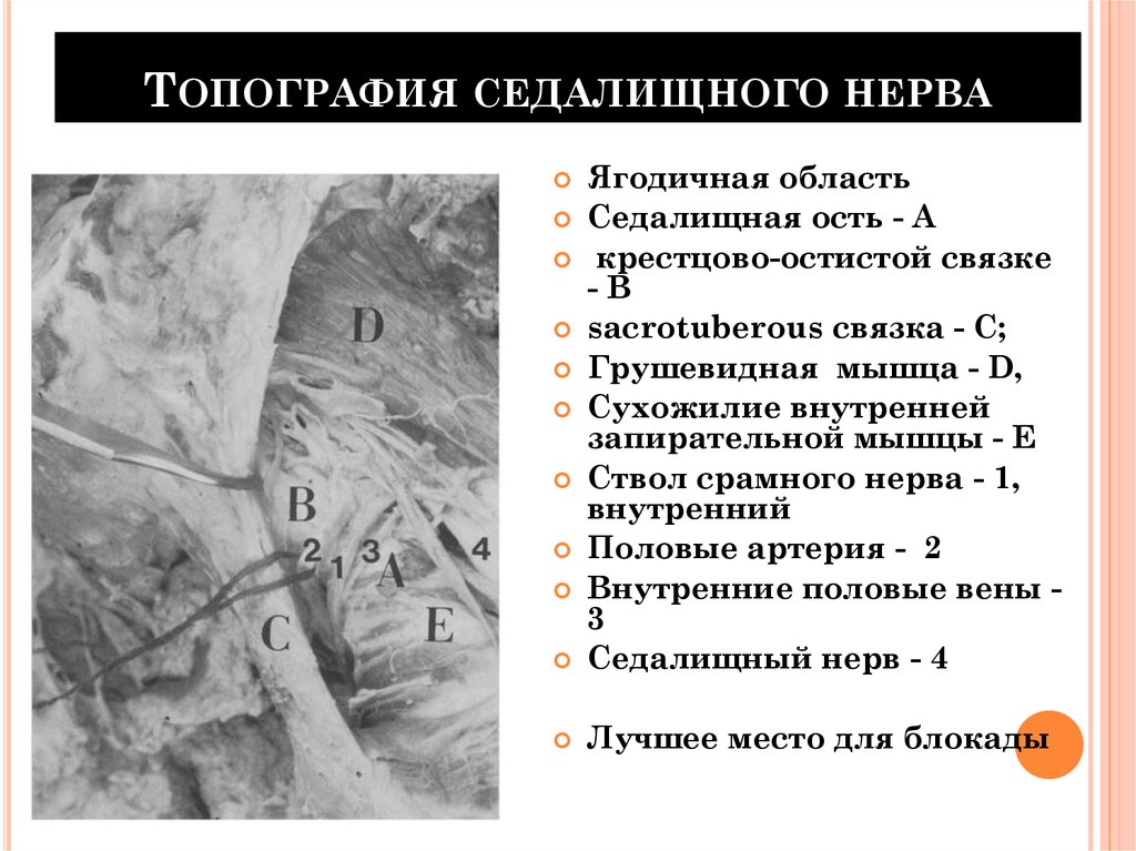 Топография седалищного нерва схема