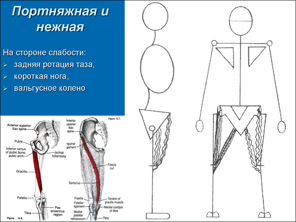 Портняжная. Ротация таза. Портняжная конечность. Ротация анатомия. Ротация мышцы это.