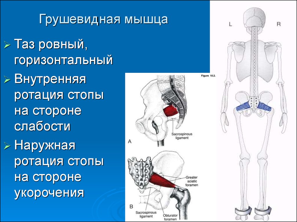 Грушевидная мышца где находится фото