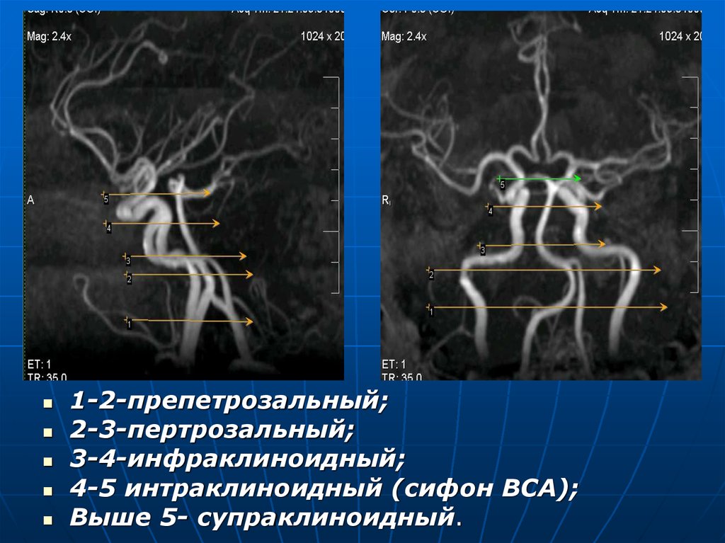 Сегменты вса на кт схема