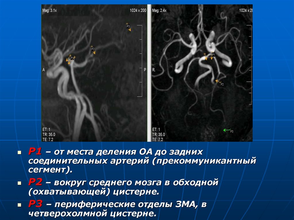 Ангиография что это за обследование