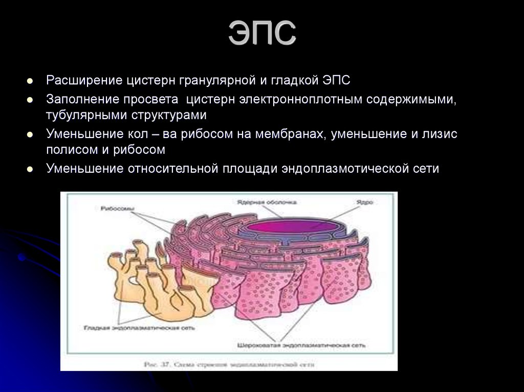 Гранулярная эпс. ЭПС строение цистерны. Структура гранулярной ЭПС. Цистерны гранулярной ЭПС. Гиперплазия цистерн ЭПС.