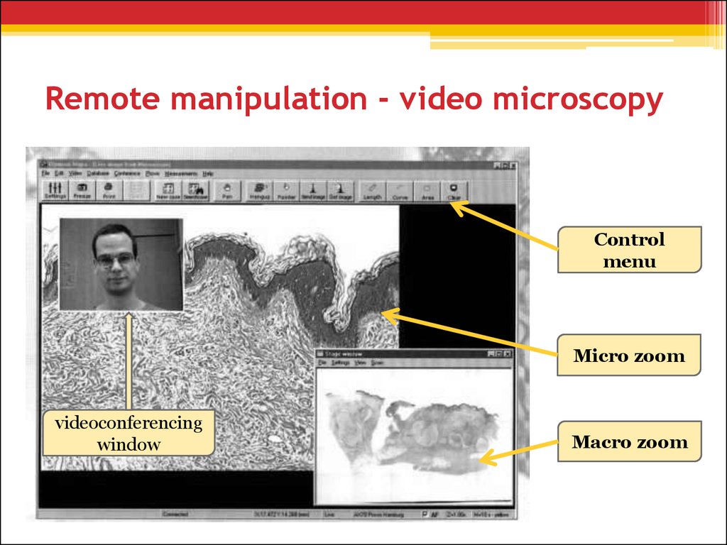 Remote manipulation - video microscopy