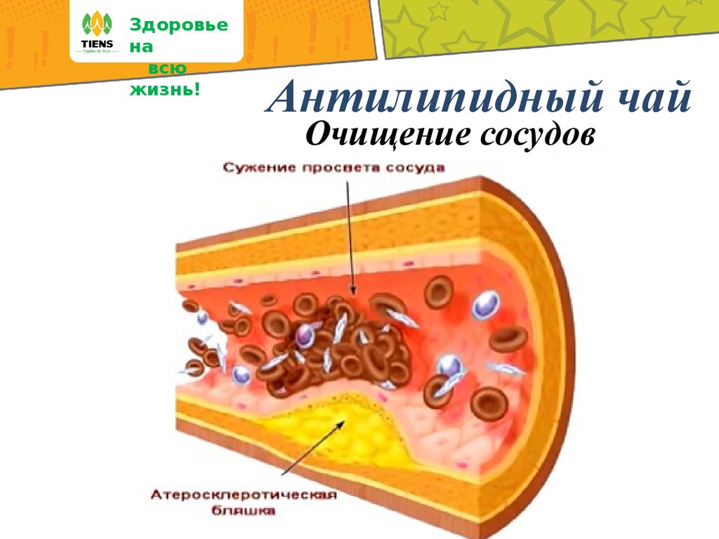 Продукты от бляшек в сосудах. Атеросклеротическая бляшка. Польза и вред холестерина. Холестерин в сосудах рисунок.