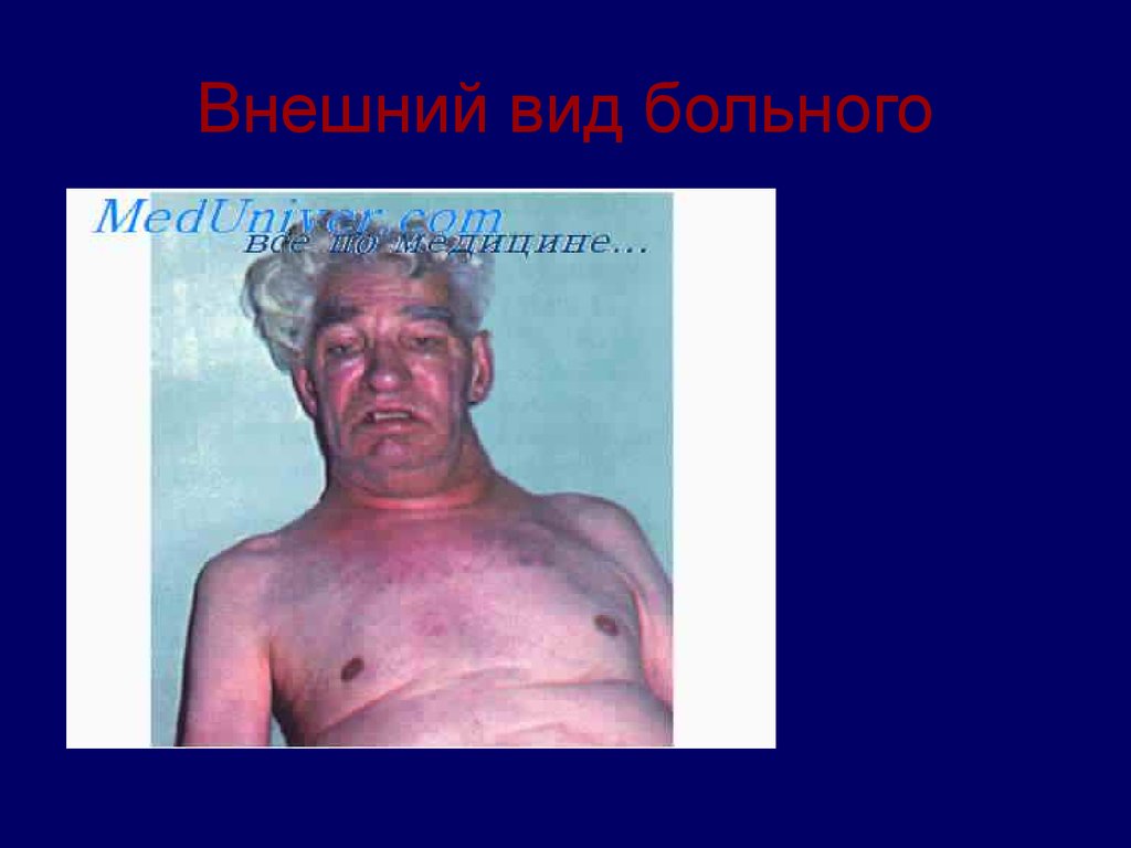 Внешний вид больного
