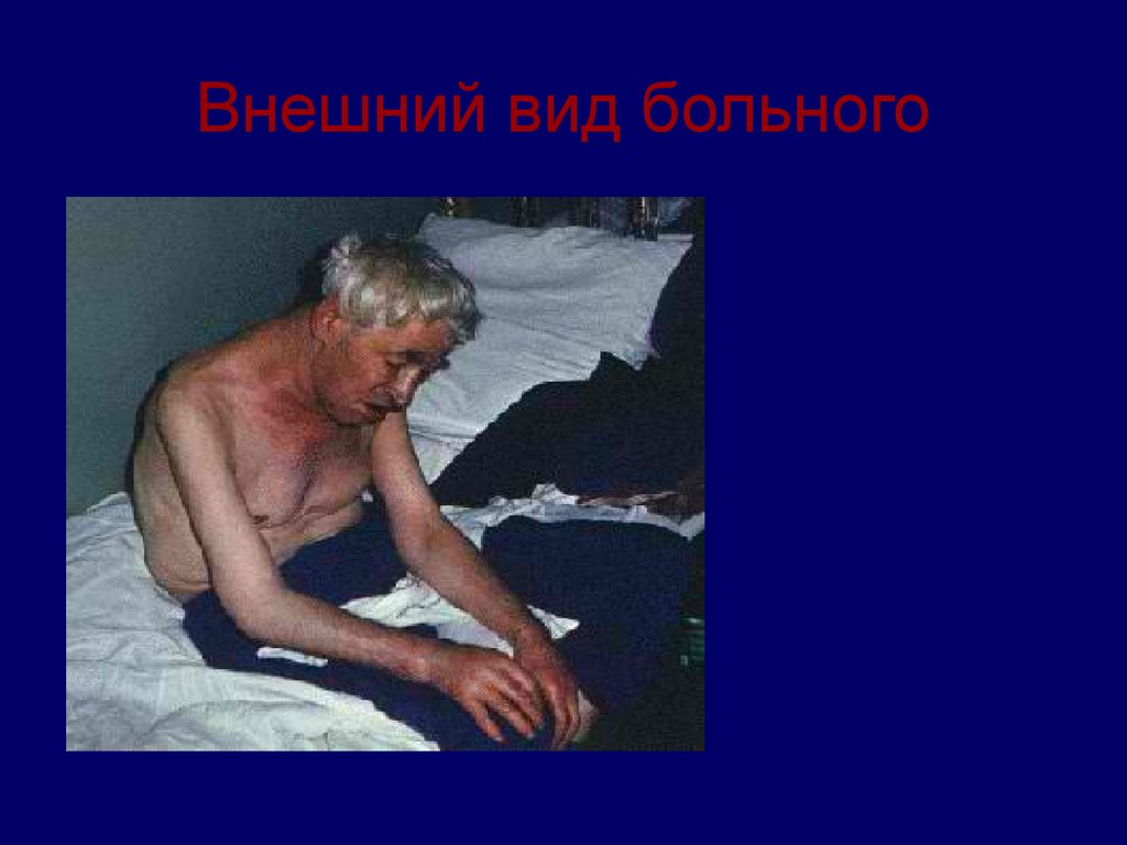 Внешний вид больного