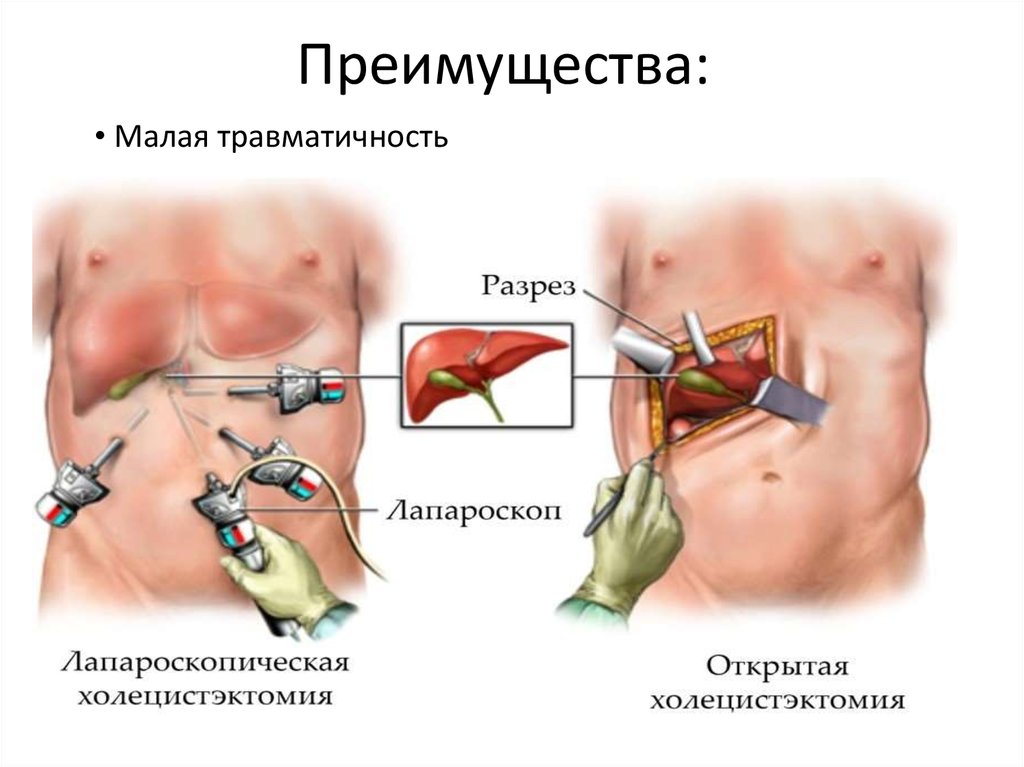 Преимущества: