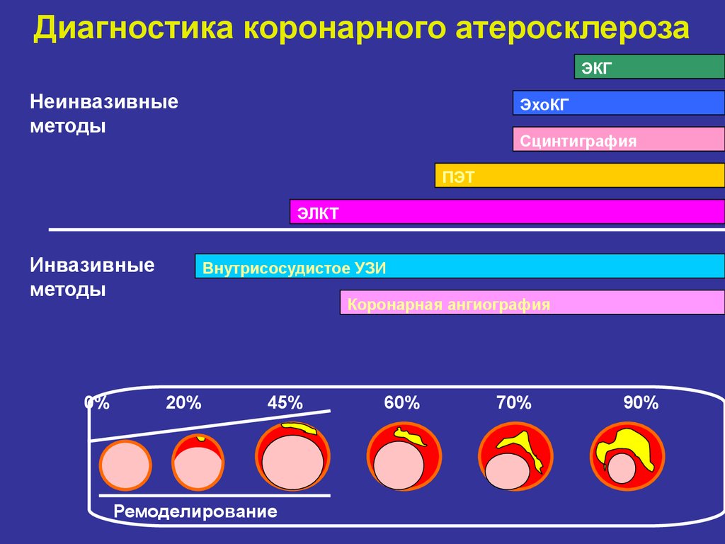 Инвазивный и неинвазивный. Методы диагностики атеросклероза. Неинвазивные методы диагностики атеросклероза. Бляшка метод диагностики. Неинвазивные методы диагностики ИБС.