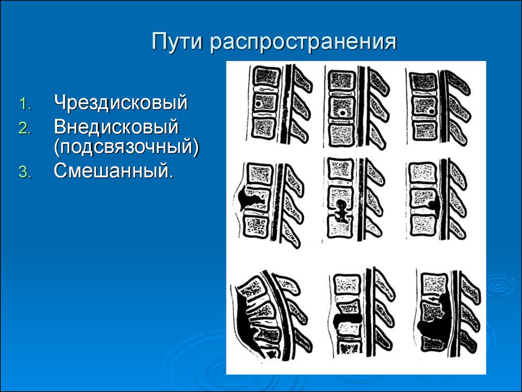 Пути распространения