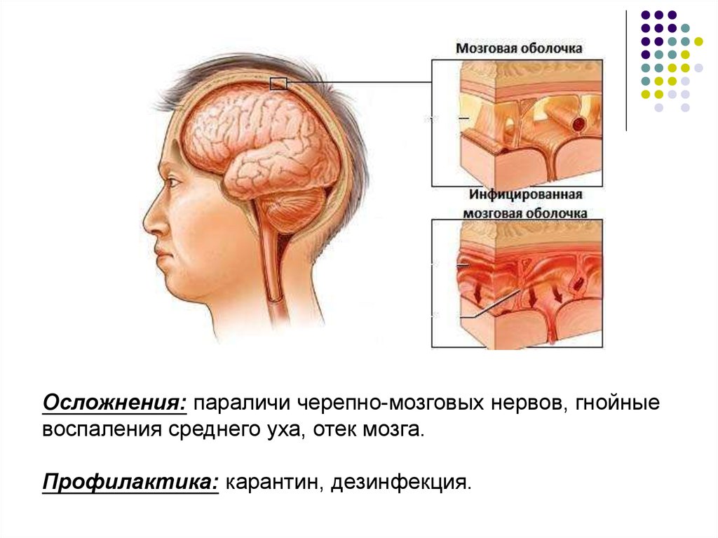 Причины отека головного мозга у взрослых