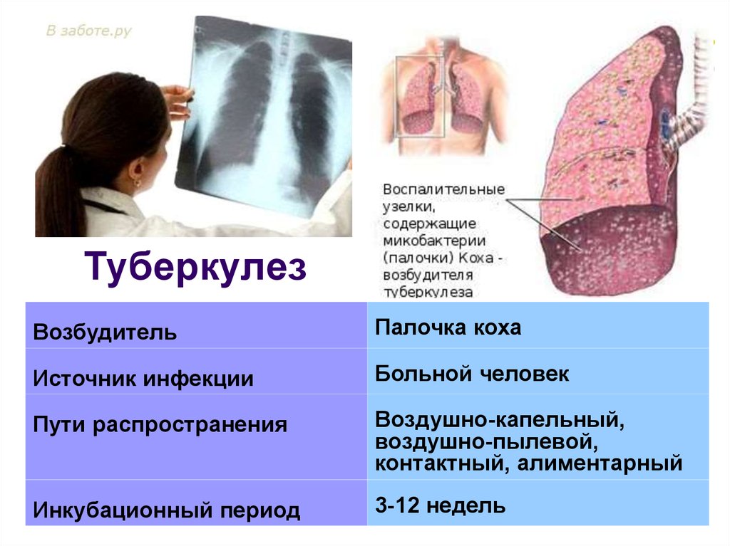 Детские болезни презентация