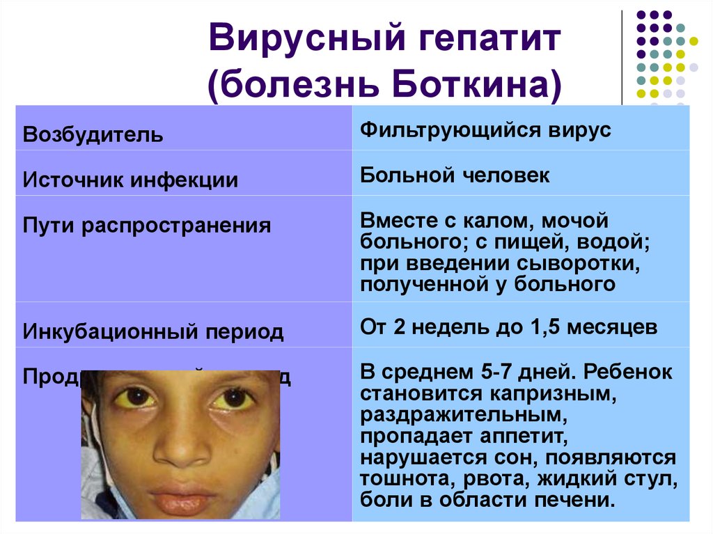 Признаки заболевания гепатитом. Боткин болезнь симптомы. Болезнь Боткина симптомы. Вирусный гепатит (болезнь Боткина).