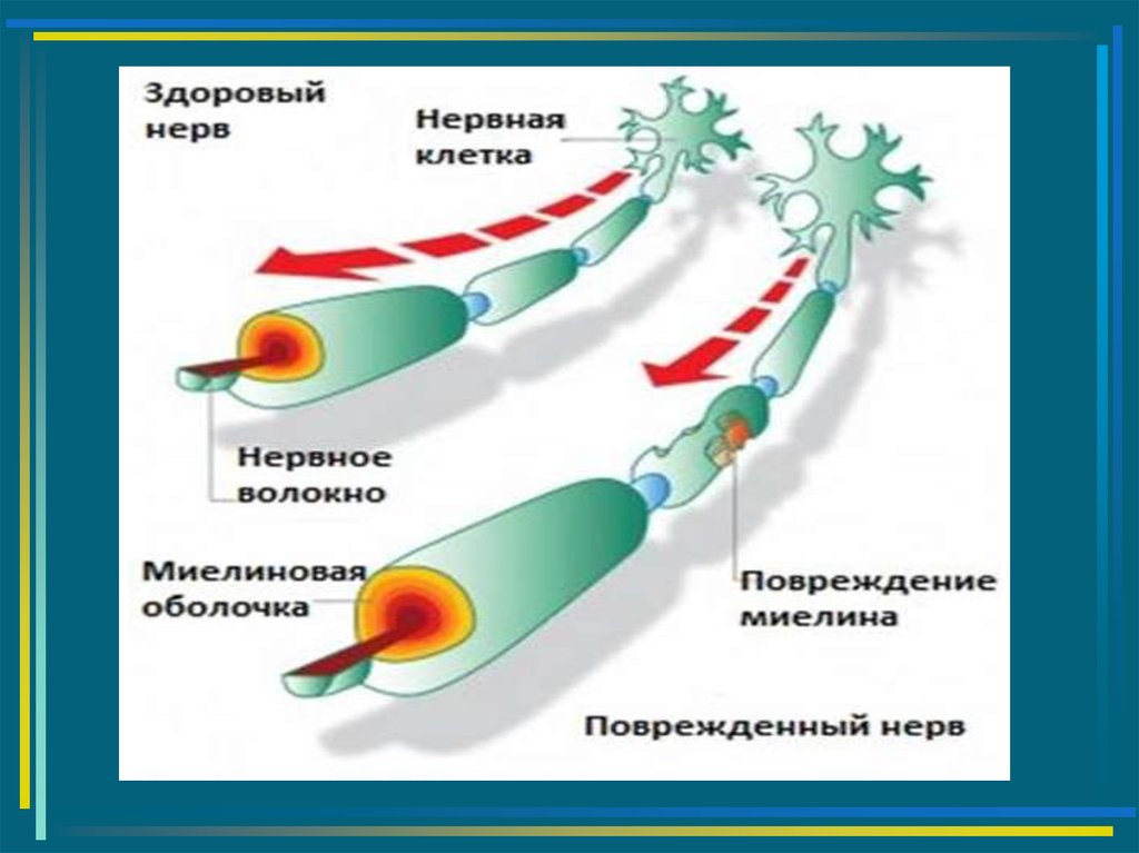 Миелиновая оболочка нервных волокон. Повреждение миелиновой оболочки. Регенерация миелиновых нервных волокон. Нервные волокна физиология. Строение миелиновой оболочки.