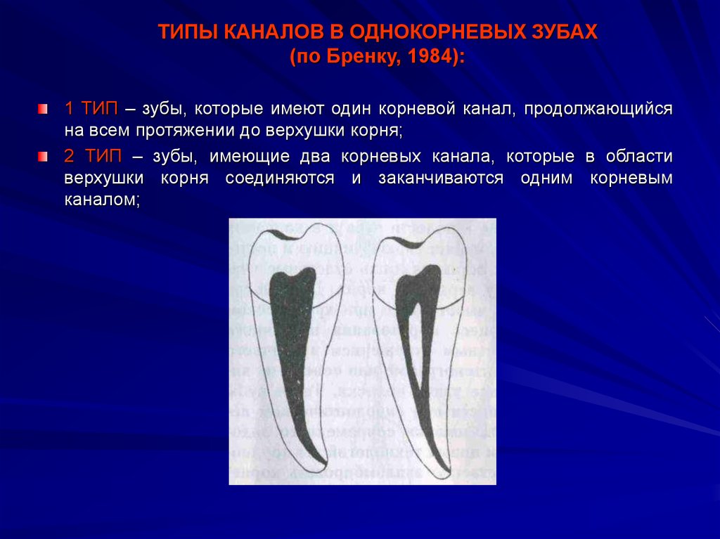 Схема корневых каналов