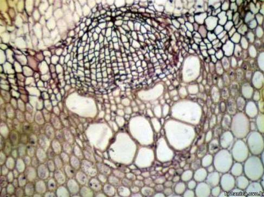 Запасная ткань растений. Запасающая ткань растений под микроскопом. Выделительная ткань растений под микроскопом. Запасающая паренхима. Проводящая ткань растений под микроскопом.