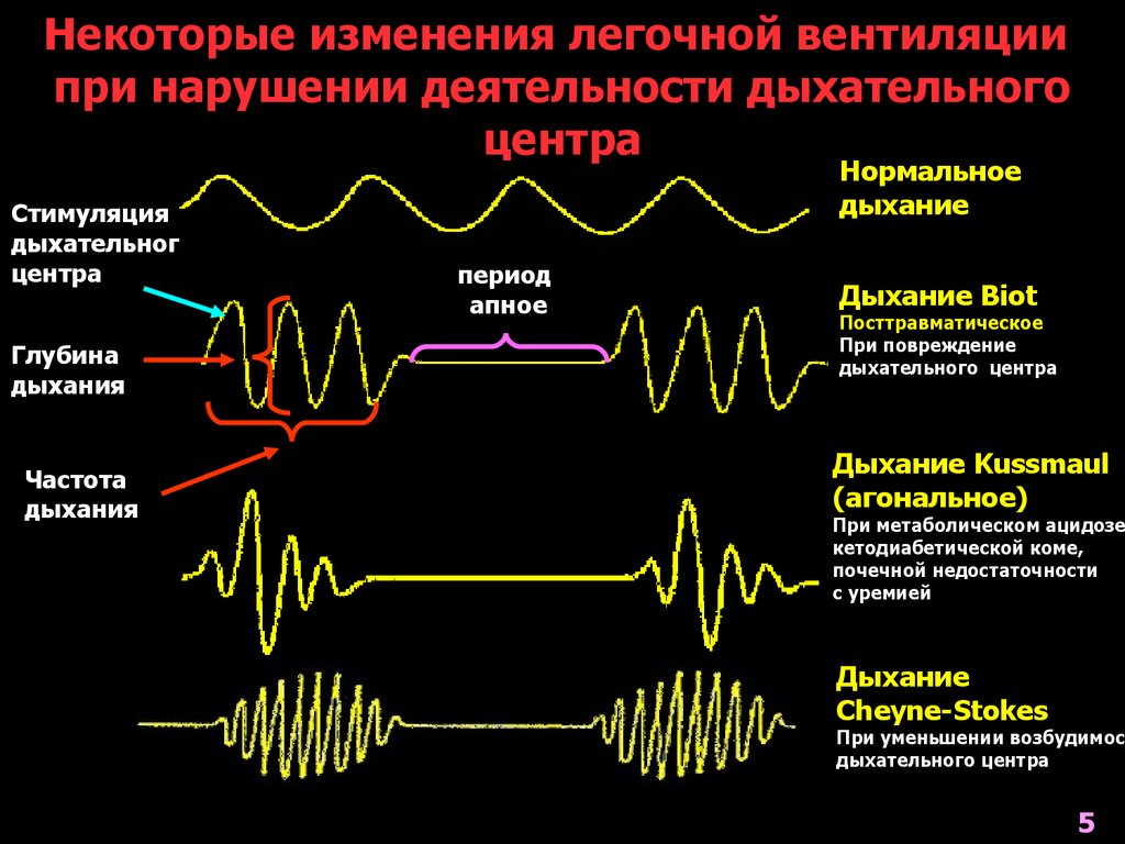 Периоды дыхания. Изменение лёгочной вентиляции. Признаки агонального дыхания. Патологические типы дыхания патофизиология. Дыхание агонального типа.