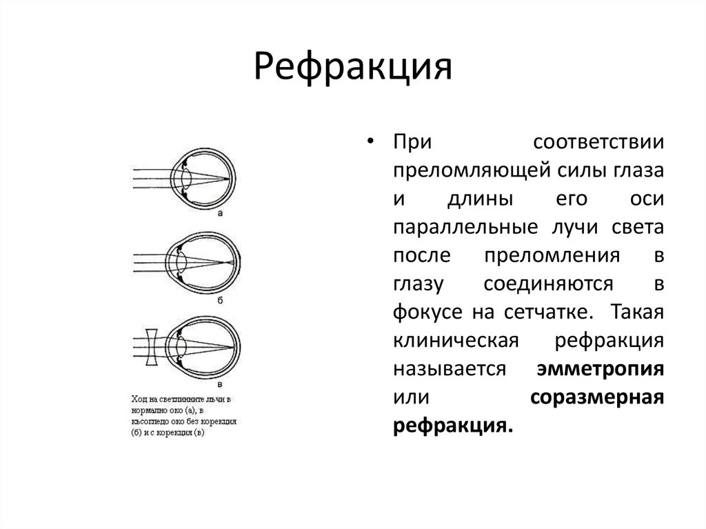 Рефракция это. Понятие первичной и вторичной рефракции глаза?. Рефракция классификация. Механизм рефракции глаза. Определение рефракции глаза.