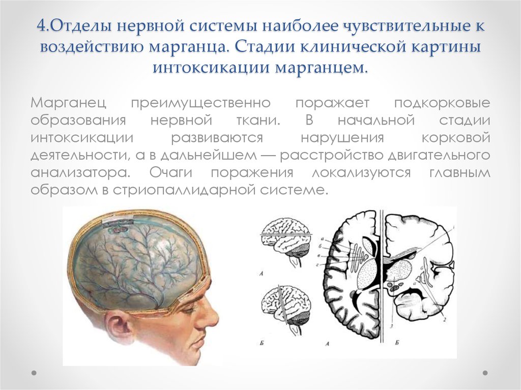 Отравление марганцем презентация