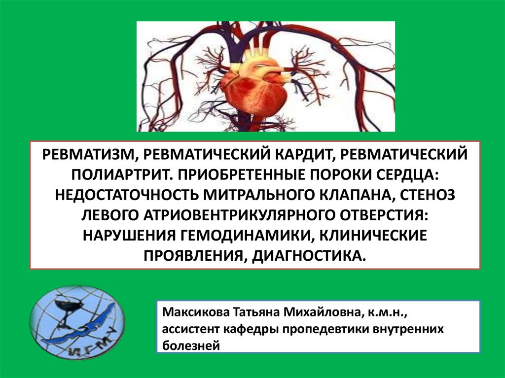 Презентация пороки сердца пропедевтика