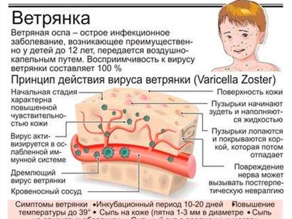 Натуральная оспа картинки