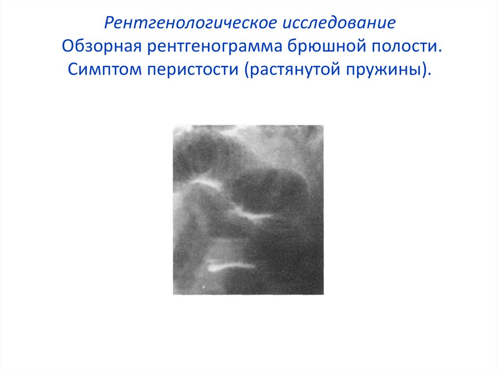 Полости симптомы