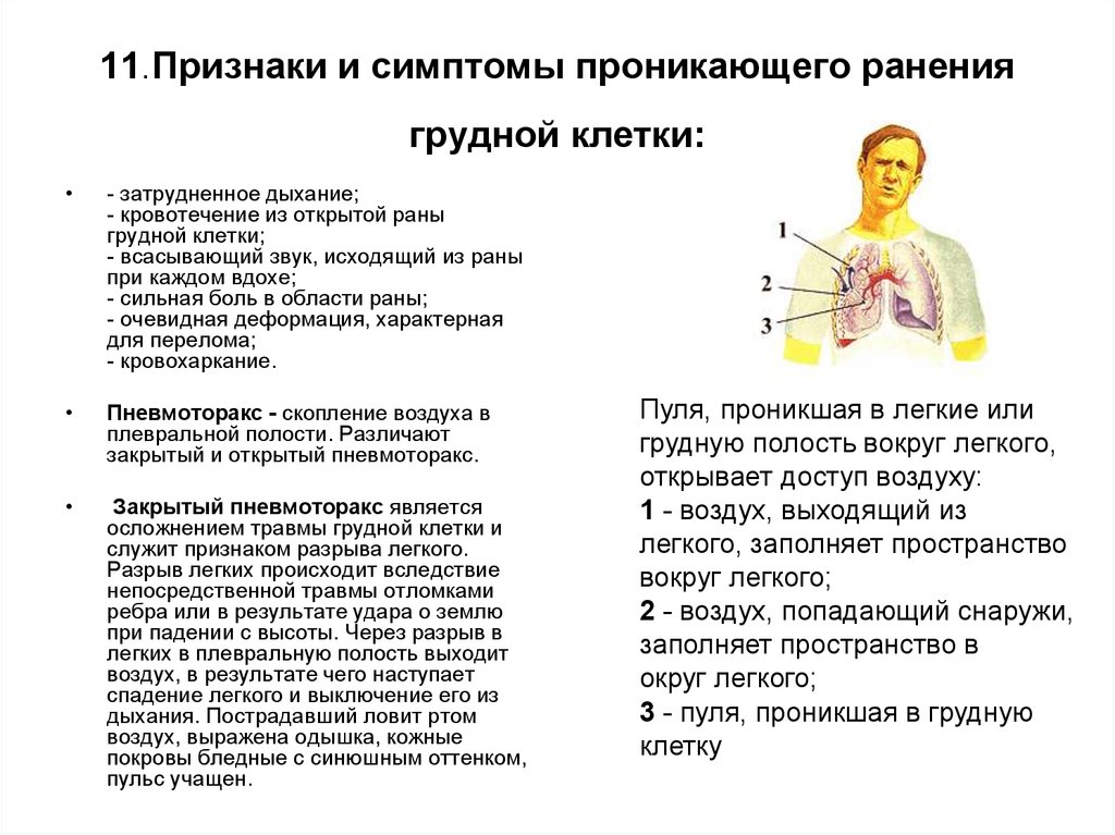 Презентация на тему сестринская помощь при травмах грудной клетки