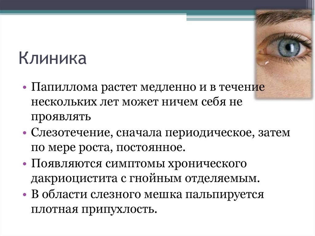 В течение нескольких лет. Хронический дакриоцистит клиника. Признак острого дакриоцистита. Симптомы хронического дакриоцистита. Признаком хронического дакриоцистита являются:.