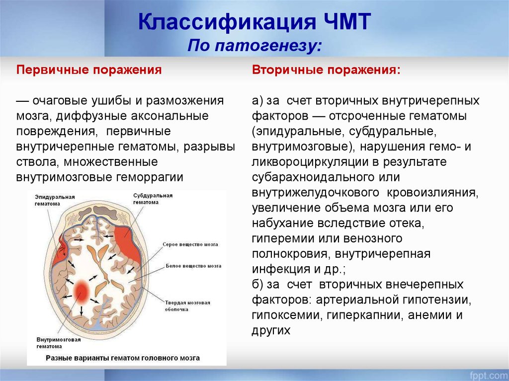 Зчмт сотрясение. Классификация травм головного мозга неврология. Ушиб головного мозга классификация. Классификация ЧМТ гематомы. Классификация травматических повреждений головного мозга.