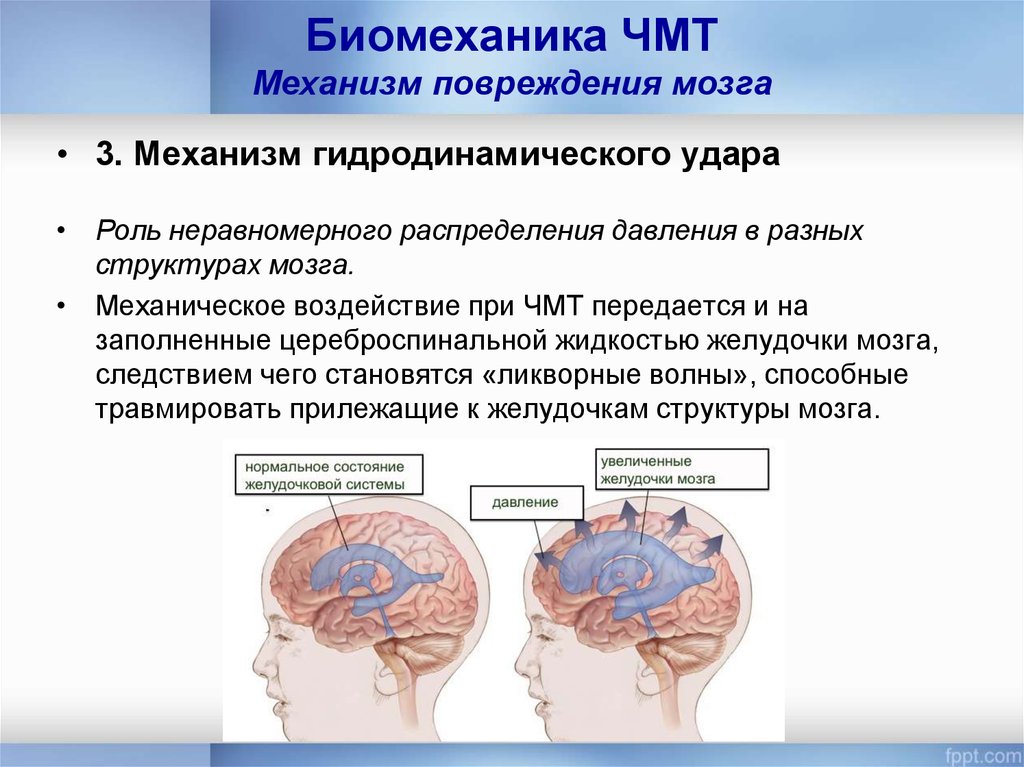 Сотрясение тела. Повреждение головного мозга. Черепно-мозговая травма. Механизм черепно-мозговой травмы.
