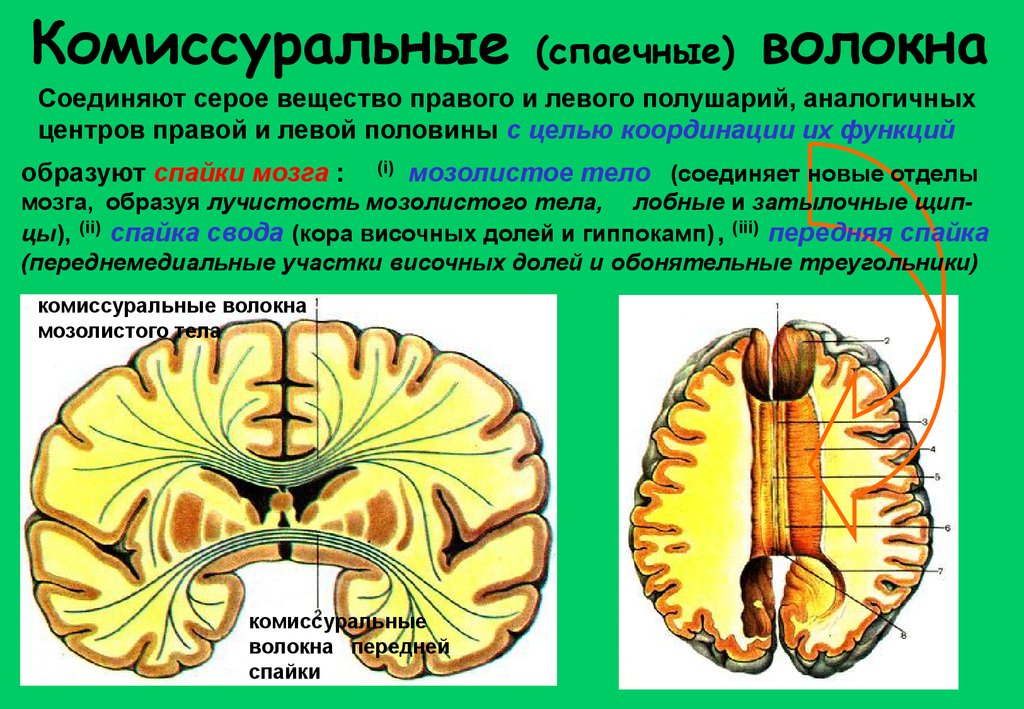 Белое вещество головного и спинного мозга образуют. Комиссуральные волокна головного мозга. Комиссуральные проводящие пути головного мозга. Комиссуральные нервные волокна головного мозга, их строение.. Волокна белого вещества ассоциативные комиссуральные.