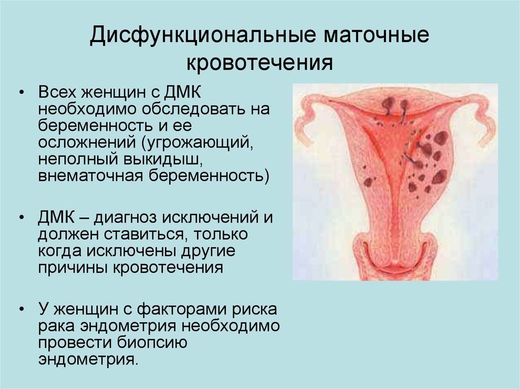 Маточное кровотечение картинки