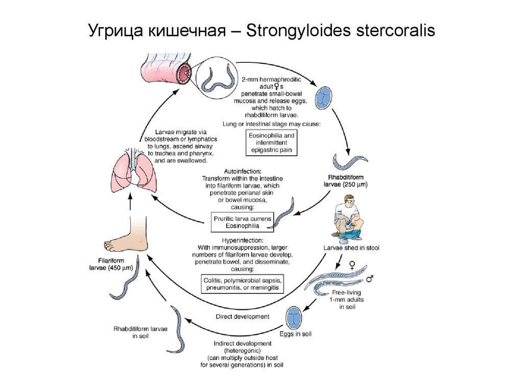 Жизненный цикл угрицы. Цикл развития угрицы кишечной схема. Жизненный цикл угрицы кишечной схема. Цикл развития strongyloides stercoralis. Угрица кишечная цикл развития.